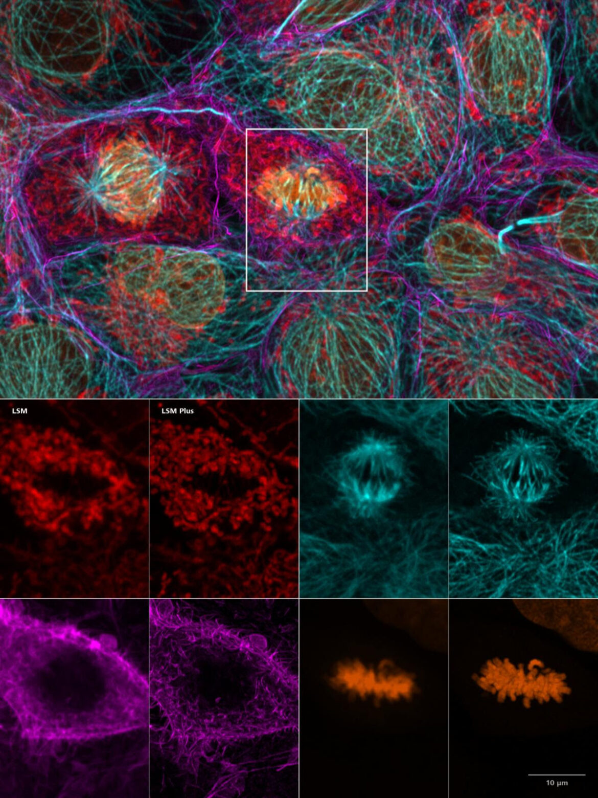 Improved Image Quality and Resolution for all ZEISS Laser Scanning Microscopes