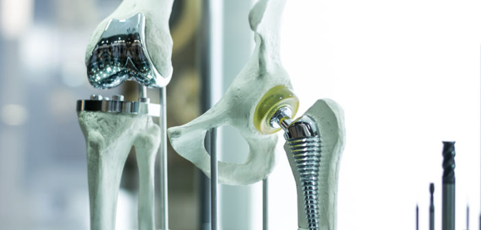 Key considerations for enhancing orthopaedic implants inspection