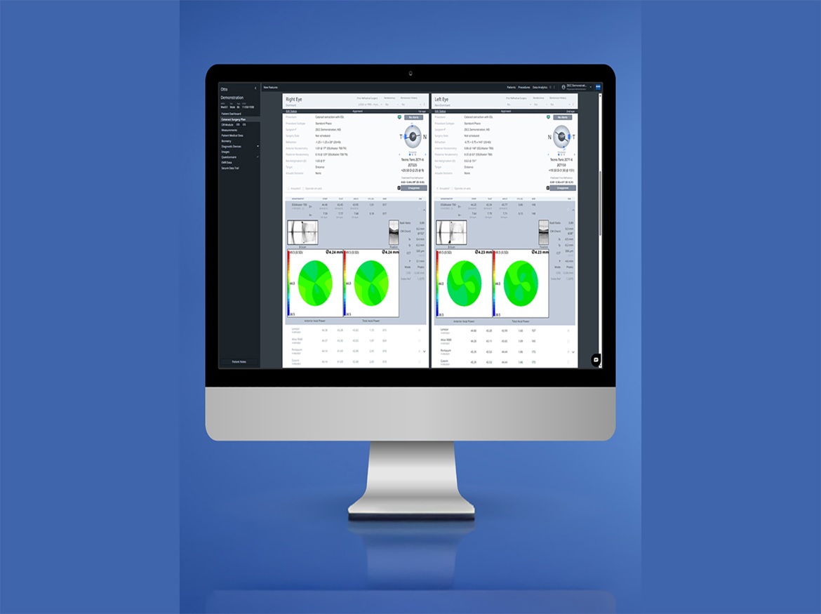 ZEISS continues to drive digital era forward in ophthalmology; celebrates 2 million digitally-planned cataract cases in the U.S. alone